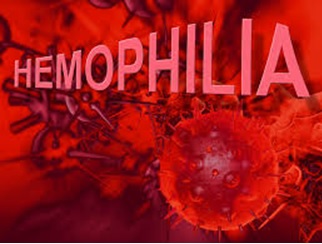 بیماری هموفیلی ( Hemophilia)