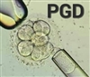 روش PGD برای تعیین جنسیت جنین و تشخیص زود هنگام بیماری های ژنتیکی