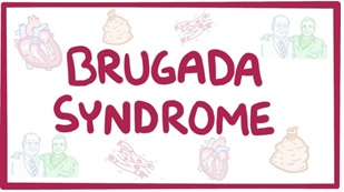سندرم بروگادا (Brugada syndrome)