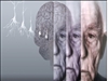آلزایمر (Alzheimer)