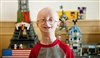 پیری زودرس کودکی (progeria)