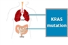 بررسی جهش KRAS در سرطان ریه و کولون